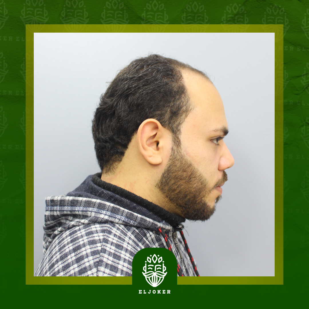 client image